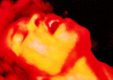 Hendrix